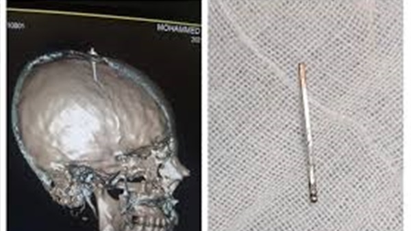 الحياة اليوم