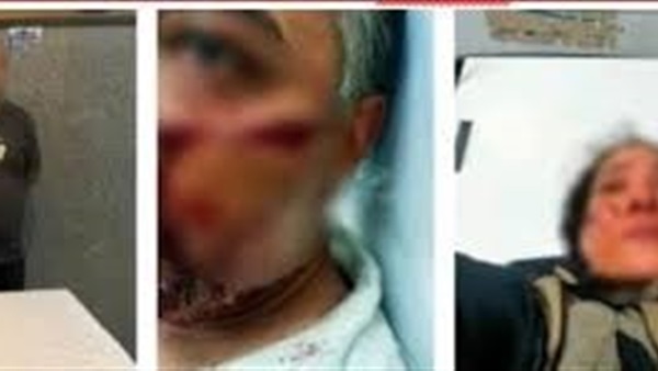 الحياة اليوم