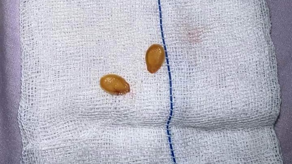 قشرة لب